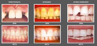 ΧΕΙΡΟΥΡΓΟΣ ΟΔΟΝΤΙΑΤΡΟΣ  ΚΑΛΑΜΑΡΙΑ  ΚΑΖΑΝΤΖΙΔΗΣ ΓΕΩΡΓΙΟΣ